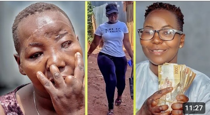 " Nilikuwa Mrembo But My Husband Destroyed My Beauty By Removing My Eye"